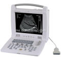 Portable Ultrasound Scanner Laptop Portable Ultrasound Harga Mesin